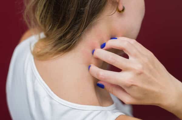 Woman scratched her neck with red scratch marks on it.
